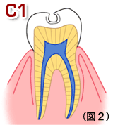 3.gif