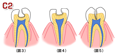 4.gif